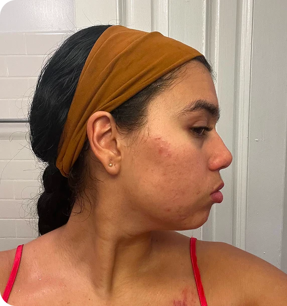Clearer, Calmer Skin